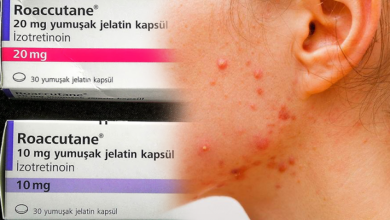 Roaccutane nedir? Nasıl kullanılır? Roaccutane yan etkileri nasıl geçer?