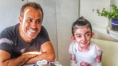 Haluk Levent’ten kelebek hastası Elfida’ya duygulandıran sürpriz