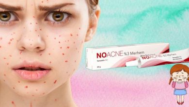 Noacne krem(merhem) ne işe yarar? Noacne krem nasıl kullanılır? Noacne krem fiyatı 2023