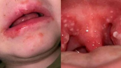 Strep A nedir? Strep A belirtileri nelerdir? Can almaya devam ediyor:3 yaşındaki Aras Sönmez…